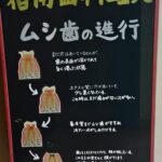 虫歯の進行について